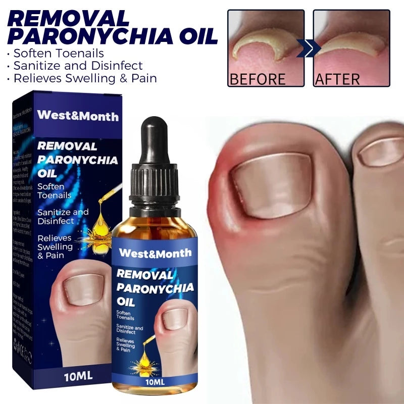 West&Month Removal Paronychia Oil