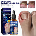 West&Month Removal Paronychia Oil