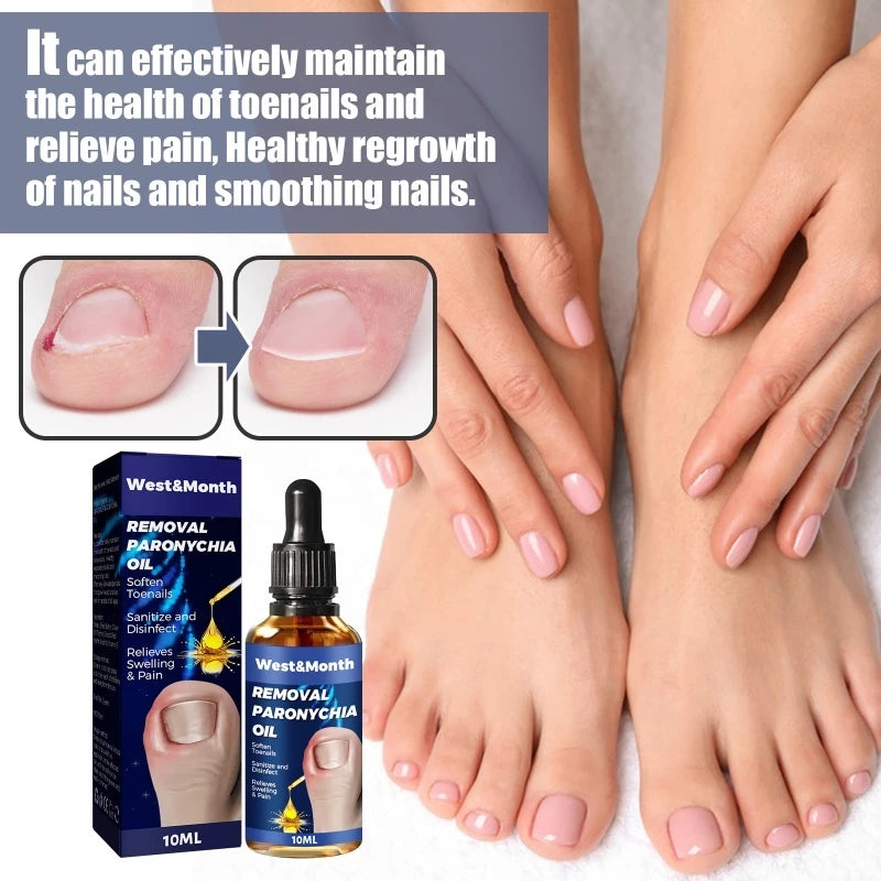 West&Month Removal Paronychia Oil