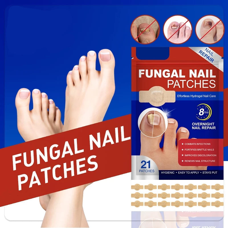Fungal Nail Patches