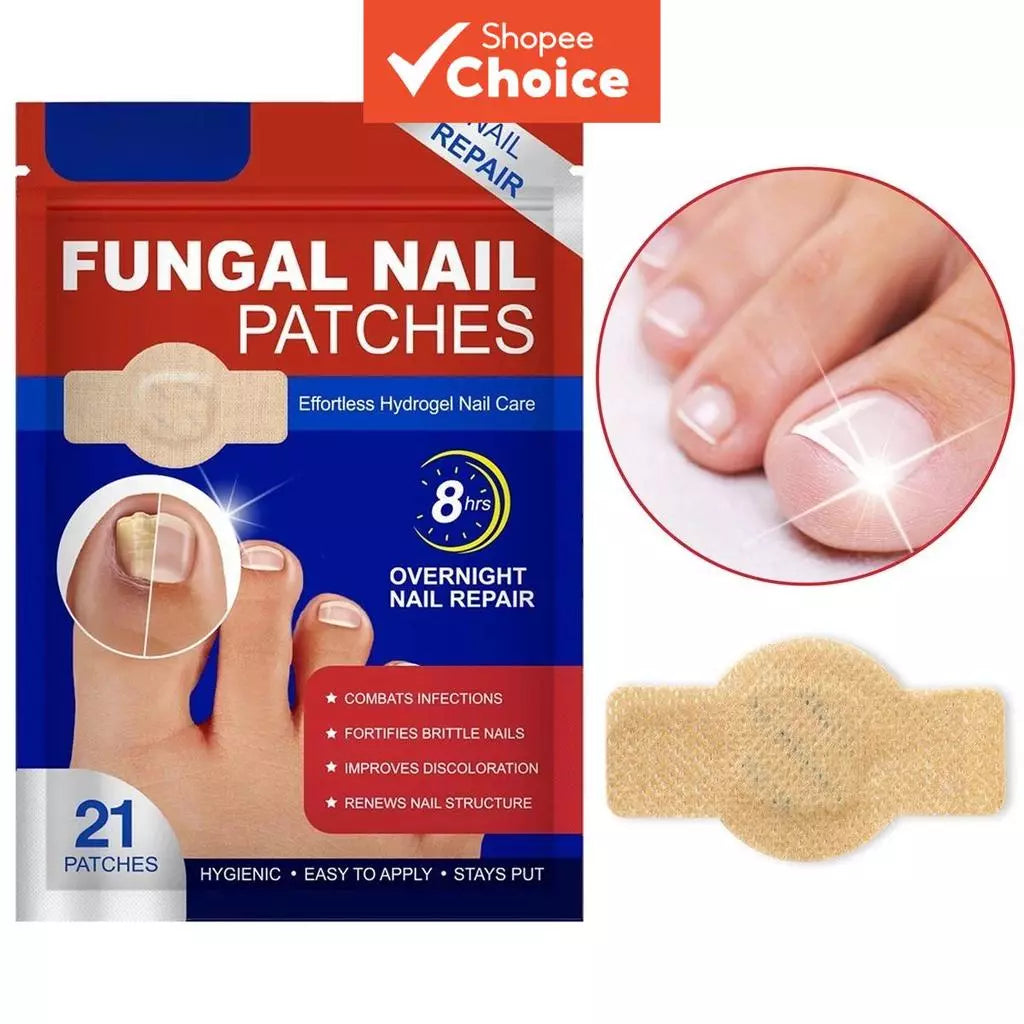 Fungal Nail Patches