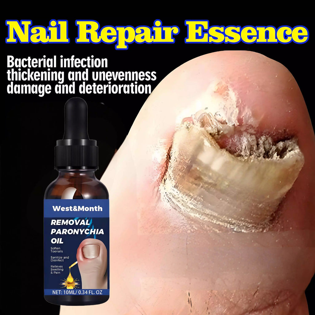 West&Month Removal Paronychia Oil